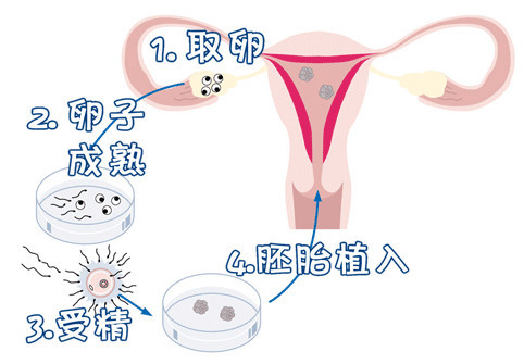 时差培养箱